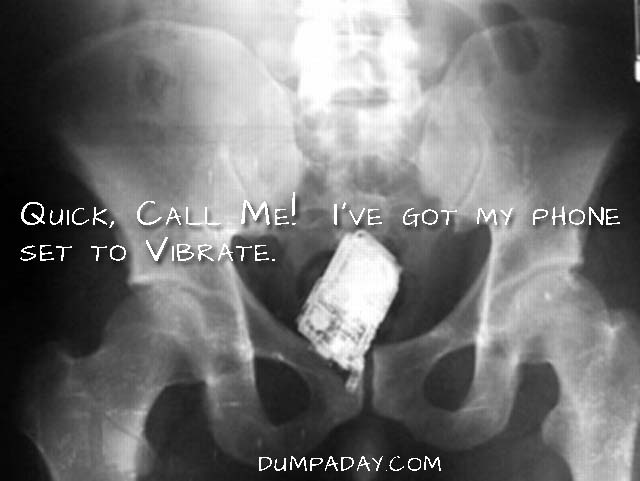 Amazing X Rays Of Random Objects Inserted Into Bizarre Places 15 Pics 8622