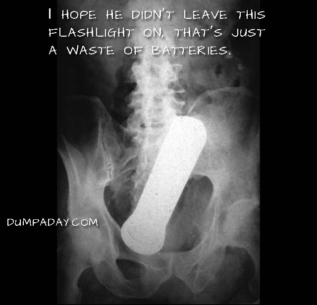 Amazing X Rays Of Random Objects Inserted Into Bizarre Places 15 Pics 9343