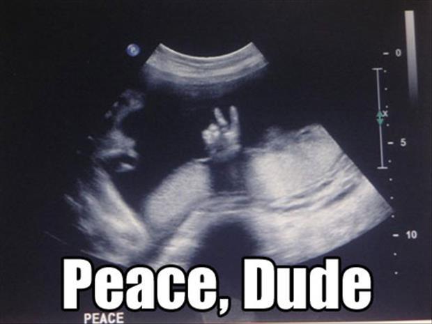 funny ultra sound pictures (17)