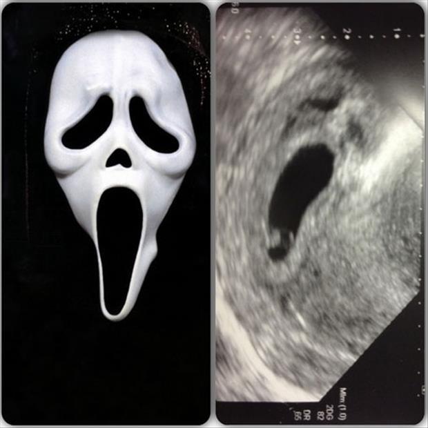 funny ultra sound pictures (18)