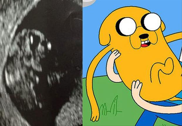 funny ultra sound pictures (3)