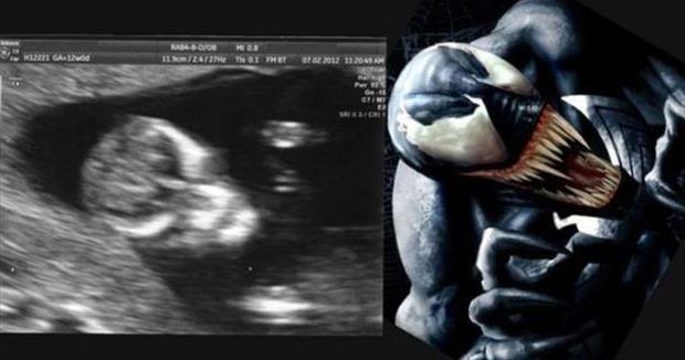 funny ultra sound pictures (4)