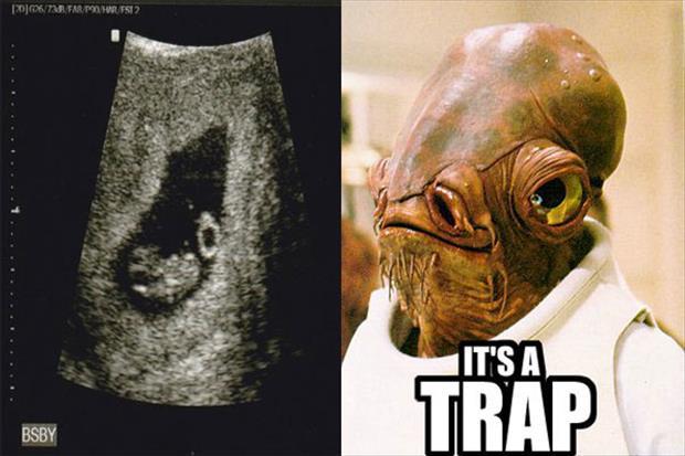 funny ultra sound pictures (6)