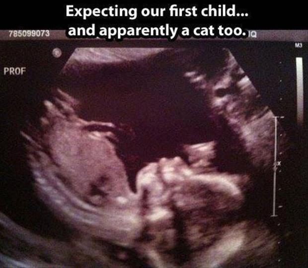 funny ultra sound pictures (8)