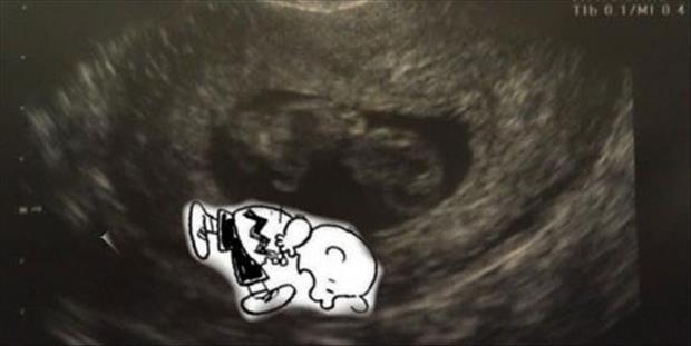 funny ultra sound pictures (9)